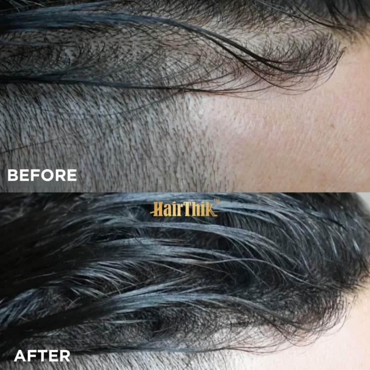 Vlasová vlákna s aplikátorem STpro Hair Thik na zahušťování vlasů - černá 25g